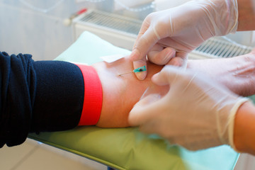 Close up of doctor hands taking blood from male vein into tube by catheter