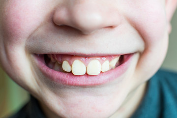 smile of a teenage boy close up