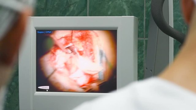 two neurosurgeons observe brain surgery in a monitor