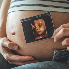 Pregnant woman holding ultrasound image.