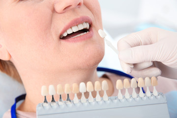 Dentist selecting patient's teeth color with palette in clinic, closeup