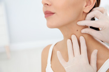 Dermatologist examining patient's birthmark in clinic, closeup. Space for text