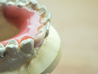 Zahnprothese Gebiss Zahntechnik