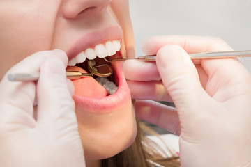 Adult young woman visiting dental office. Open mouth. Dentist hands in rubber protective gloves working with tools for patient's teeth. Closeup. Side view. 