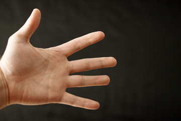 Adult hand with Raynaud's Syndrome - Phenomenon. Close up hand with fingers on dark background with copy space