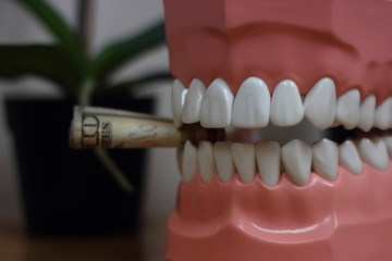 $ 10 folded  of a cigarette in the dummy of the teeth - no smoking, Smoke is the cause of unnecessary expenses to dentist