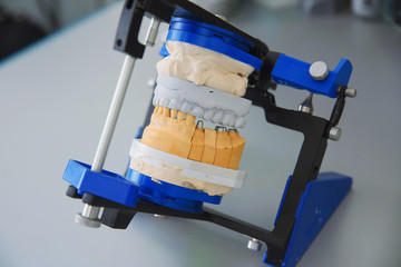 Plaster model of the upper and lower jaw of the patient of dental clinic fixed on the stand, tripod, for tests