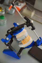 Plaster model of the upper and lower jaw of the patient of dental clinic fixed on the stand, tripod, for tests