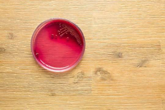 Staphylococcus aureus bacteria in blood agar Petri dish
