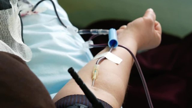 Woman squeezes her arm while lying on a couch during blood donation. Donated blood for transfusion. Close up