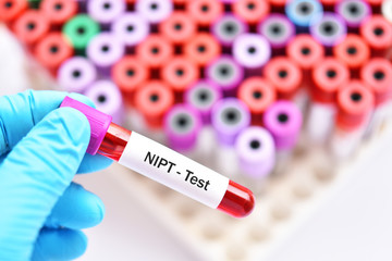 Blood sample for NIPT or Non Invasive Prenatal Testing, diagnosis for fetal Down syndrome in...
