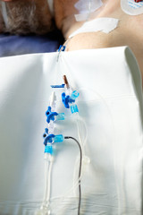 Central venous jugularis catheter connectors, intensive care unit, patient in critical stance.