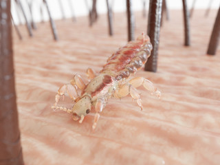 3d rendered illustration of a head louse