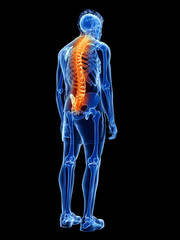 3d rendered medically accurate illustration of a man having back pain