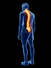3d rendered medically accurate illustration of a man having back pain