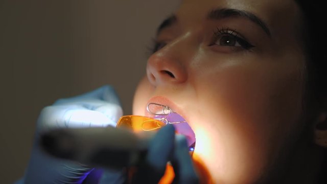 Dentist doing a dental treatment on a female patient.