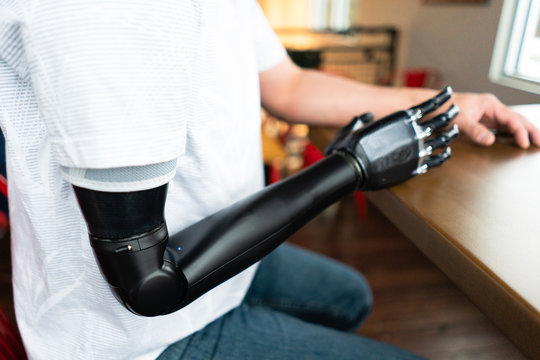 Man with a robotic arm sits at a table