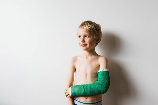 Shirtless Boy With Broken Arm Standing At Home