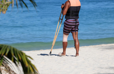 Accident tourist man are walking by crutches on the beach while travel