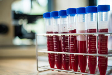 blood sample in test tube at laboratory. Medical, pharmaceutical and scientific research and development concept.