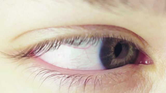 Blinking human eye. Constriction of the iris in bright light. Eyeball look to the right. The work of the eye pupil with contact with a large amount of light. Pupil constriction process