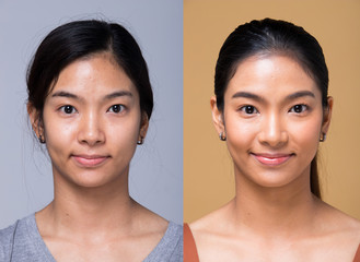 Asian Woman before applying make up hair style. no retouch, fresh face with acne, lips, eyes, cheek, nice smooth skin. Studio lighting white background, for aesthetics therapy treatment