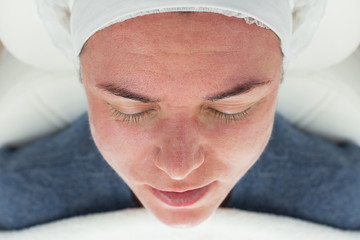 Close-up of Laser rejuvenating facial face treatment at cosmetology clinic. Young woman getting...