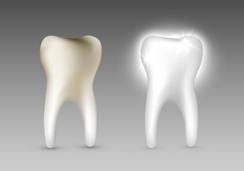 Beautiful realistic dentist vector set of decayed and white shiny tooth on grey background.