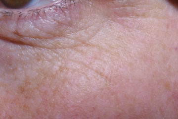 detail of eye bags and wrinkles of a middle-aged woman