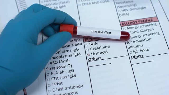 Uric acid, doctor checking name in lab blank, showing blood sample in tube