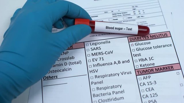 Blood sugar, doctor checking disease in lab blank, showing blood sample in tube