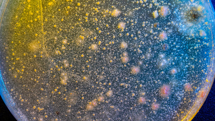 close up petri dish with microbe colony