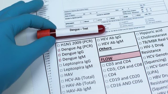 Dengue, doctor checking disease in lab blank, showing blood sample in tube