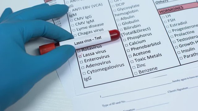 Lassa virus, doctor checking disease in lab blank, showing blood sample in tube