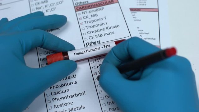 Female hormone, doctor checking name in lab blank, showing blood sample in tube