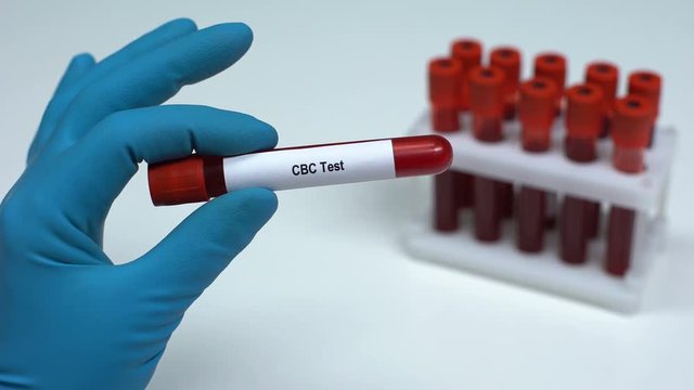 CBC test, doctor showing blood sample in tube, lab research, health check-up