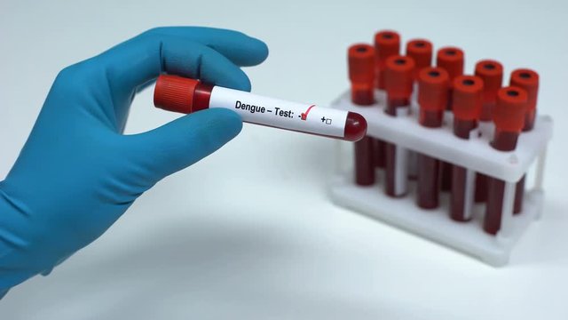 Negative dengue test, doctor showing blood sample, lab research, health check-up