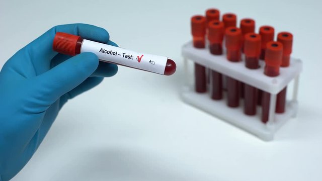 Negative alcohol test, doctor showing blood sample, lab research health check-up