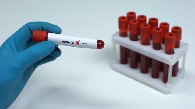 Negative acetone test, doctor showing blood sample, lab research health check-up