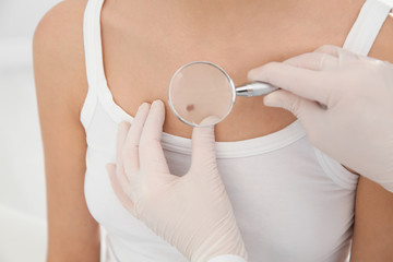 Naklejka premium Dermatologist examining patient's birthmark with magnifying glass in clinic, closeup