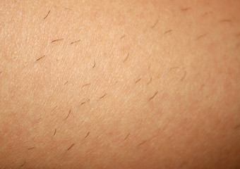 Regrown hair on the skin after shaving