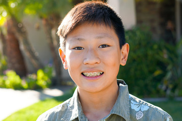 Portrait of young Asian boy with tooth braces. Young teen boy smiling and showing his orthodontic braces on his teeth.