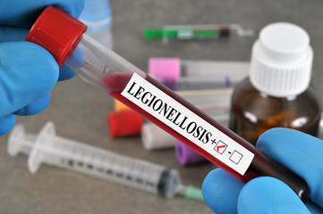 Legionella blood test