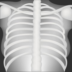 Fototapeta premium Chest X-rays in upright position for medical study and learning. Easily understand with important structure of thorax, bone, clavicles, ribs, heart, lungs, trachea and upper part of abdomen.