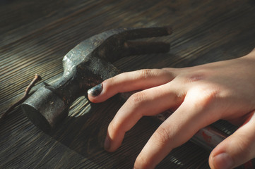 Hand with blackened thumbnail over a hammer
