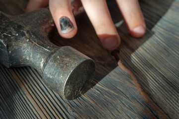 Hand with blackened thumbnail over a hammer