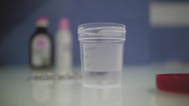 empty urine container with lid open on the doctor's table.container for urine analysis