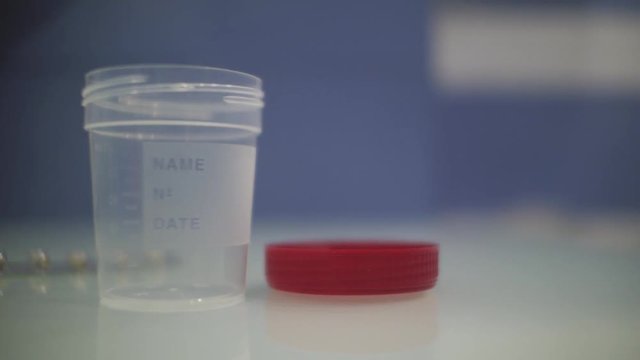 empty urine container with the lid open on the doctor's desk.container for urine analysis