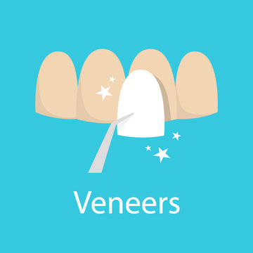 Veneer Concept. Idea Of Tooth Restoration And Crown