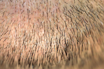 Male stubble close-up - short hair beard,